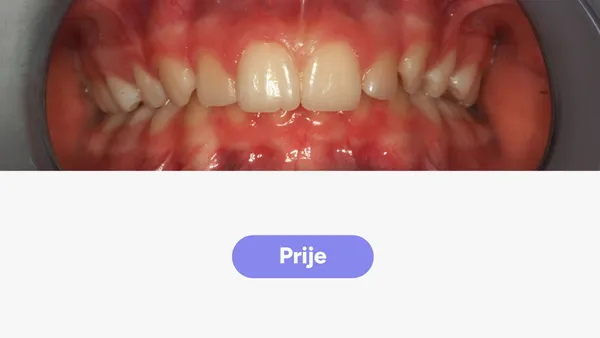 Orto Karla T Fullface Prije V2