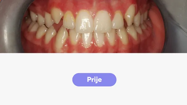 Orto Vito J Fullface Prije V2
