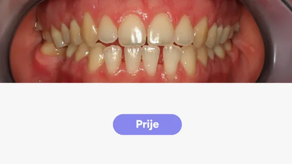 Orto Tea S Fullface Prije V2
