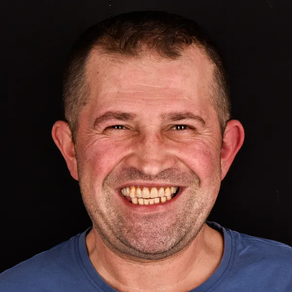 Denis Prije 1600